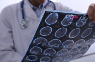 Médico com estetoscópio segura e analisa um exame cerebral.