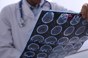 Médico com estetoscópio segura e analisa um exame cerebral.