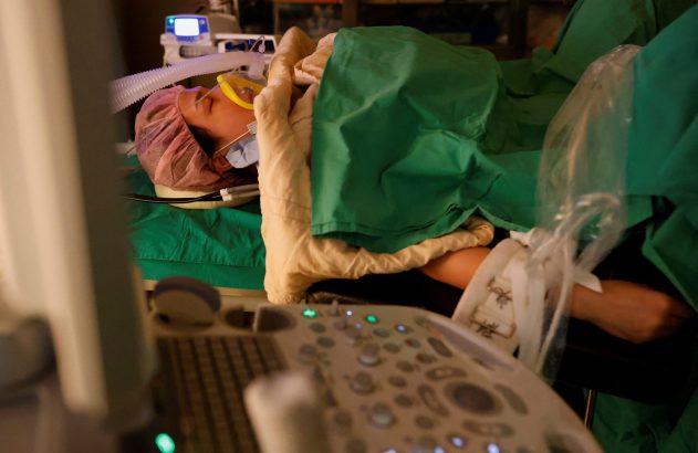 Paciente em procedimento médico coberto por campos estéreis, com máquina de ultrassom em primeiro plano.