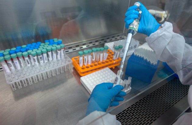 Mão com luva azul pipetando líquido em tubo de ensaio dentro de um laboratório, com tubos e racks visíveis.